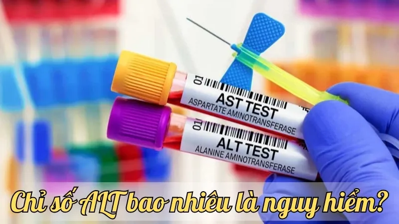 Chỉ số ALT bao nhiêu là nguy hiểm? Những dấu hiệu cảnh báo và giải pháp