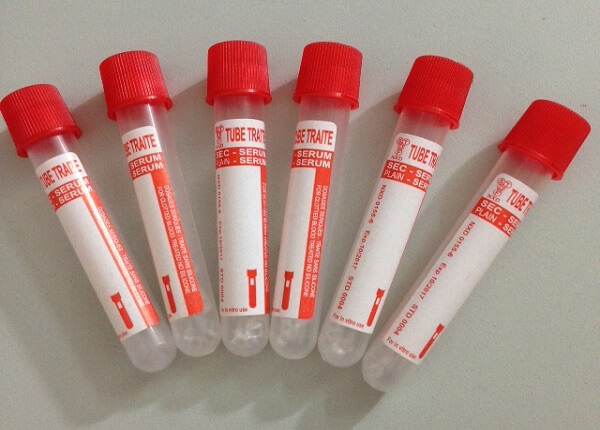 Ống nghiệm huyết thanh