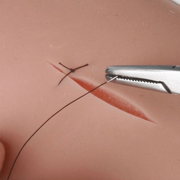 CHỨC NĂNG CỦA CHITIN