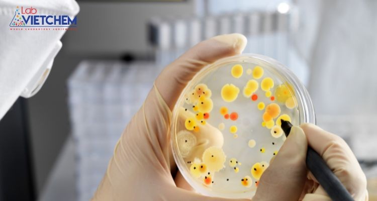 Đếm khuẩn lạc bằng tay