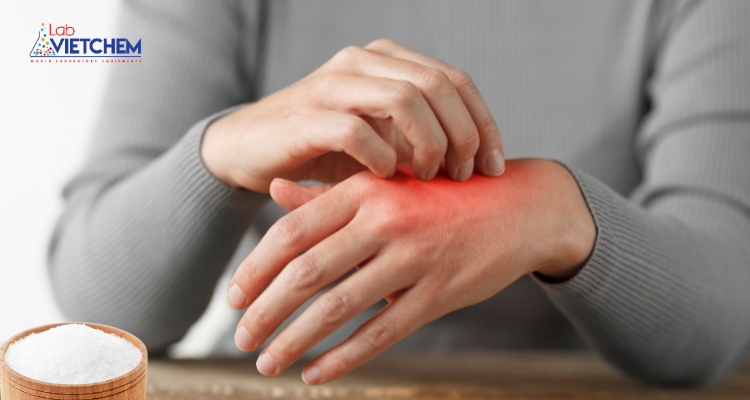 Axit chanh gây kích ứng da