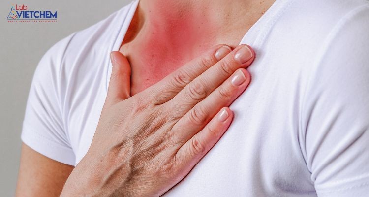 Bụi niken có thể gây viêm phế quản