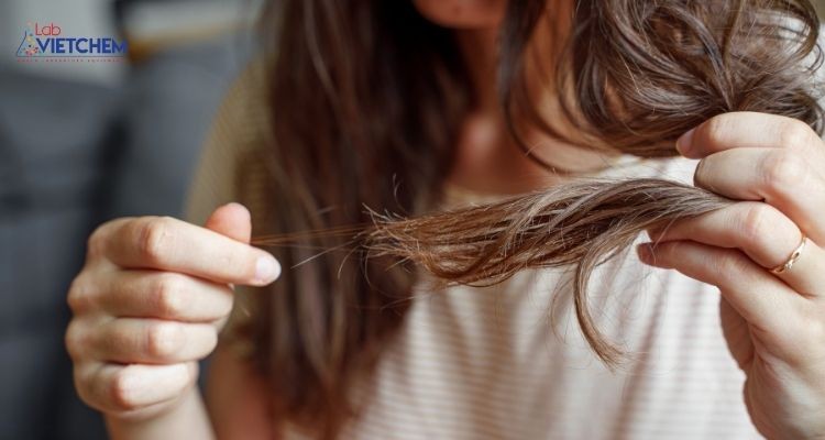 Hạn chế sử dụng dầu gội có chứa SLES cho người có tóc khô, xoăn