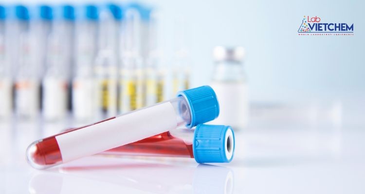 ống nghiệm EDTA