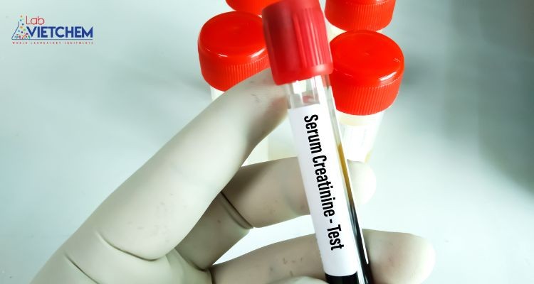 Ống nghiệm huyết thanh