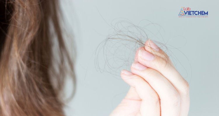 Gội đầu bằng nước có chứa clo có thể gây gãy tóc