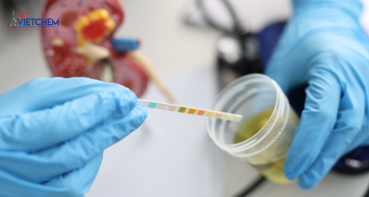 Cách sử dụng giấy quỳ và giấy pH