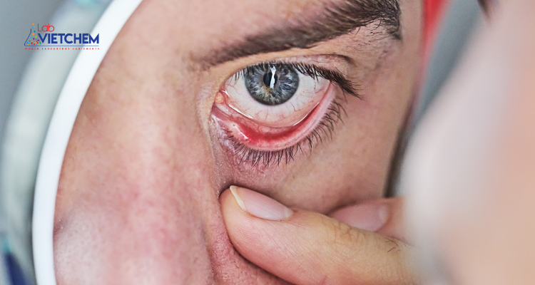 Siligel văng vào mắt có thể gây khô mắt