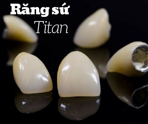 Chân răng giả làm từ titan