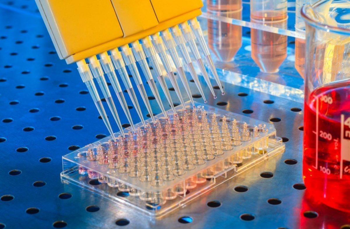 Chuyển kháng nguyên sang đĩa ELISA