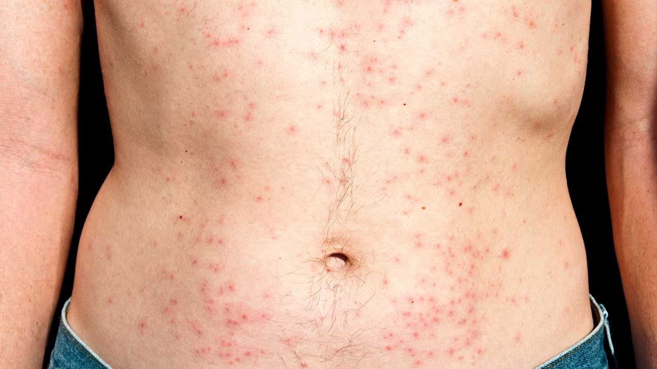 Máy đo clo - Clo gây bệnh nguy hiểm cho con người