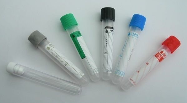 Ống nghiệm máu là gì?