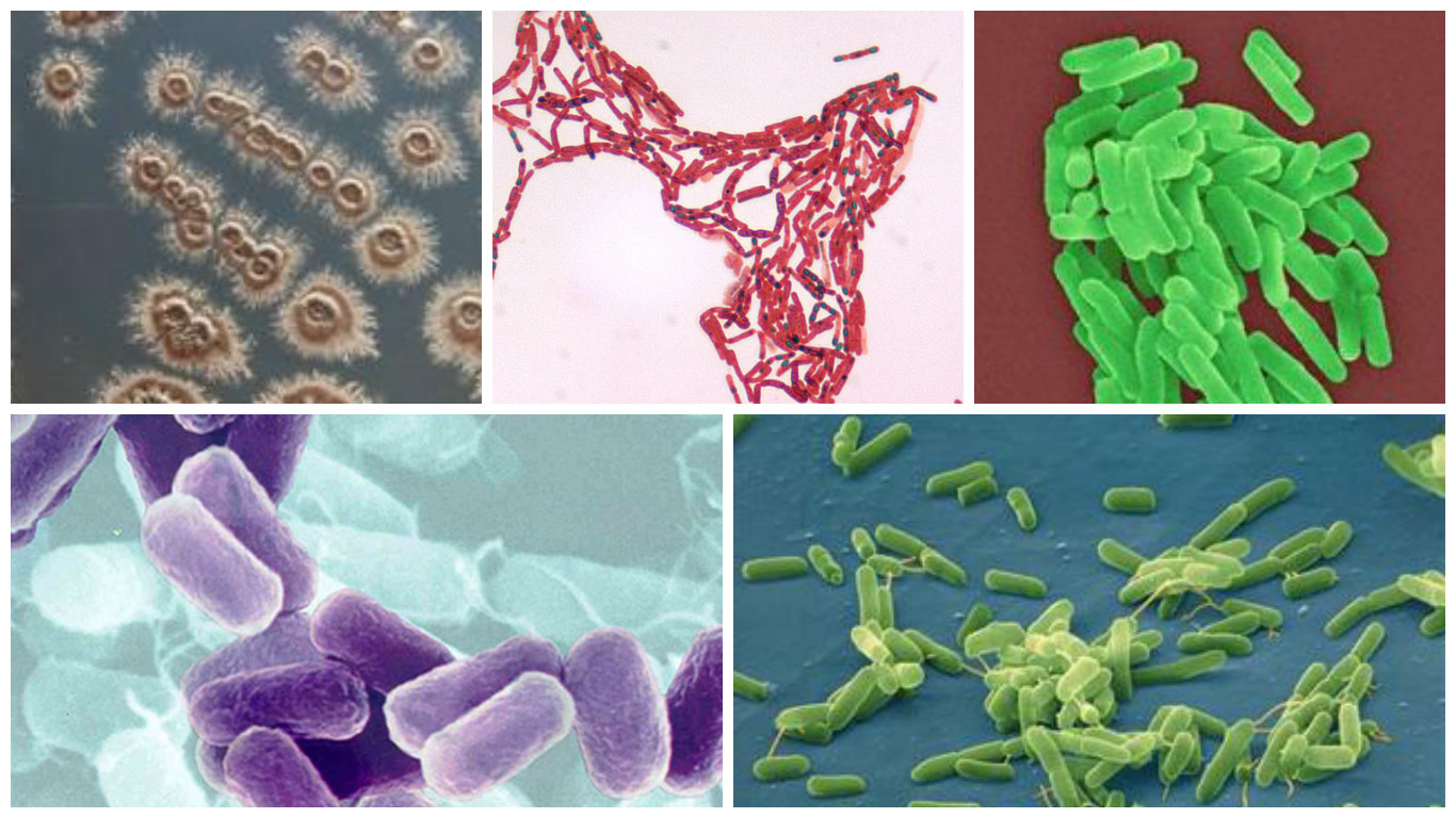 VI SINH LÝ LÀ GÌ? ĐẶC ĐIỂM CHUNG CỦA VI SINH VẬT