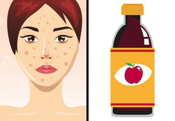 Công dụng của axit axetic