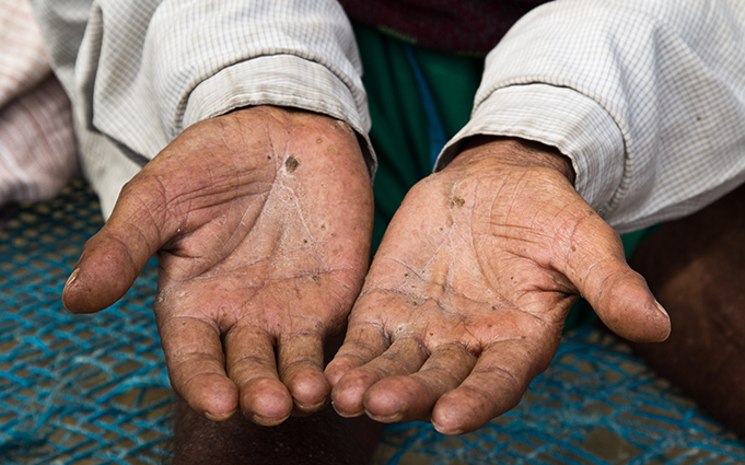 Hóa chất Asen là chất độc nguy hiểm cho con người